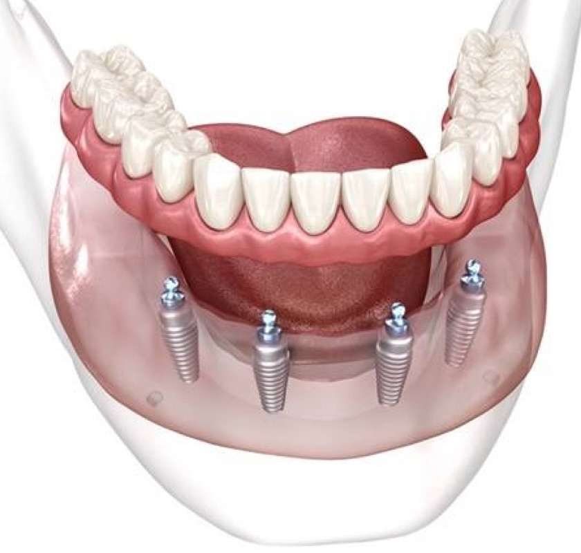 Can You Pass The whitening strips for teeth Test?